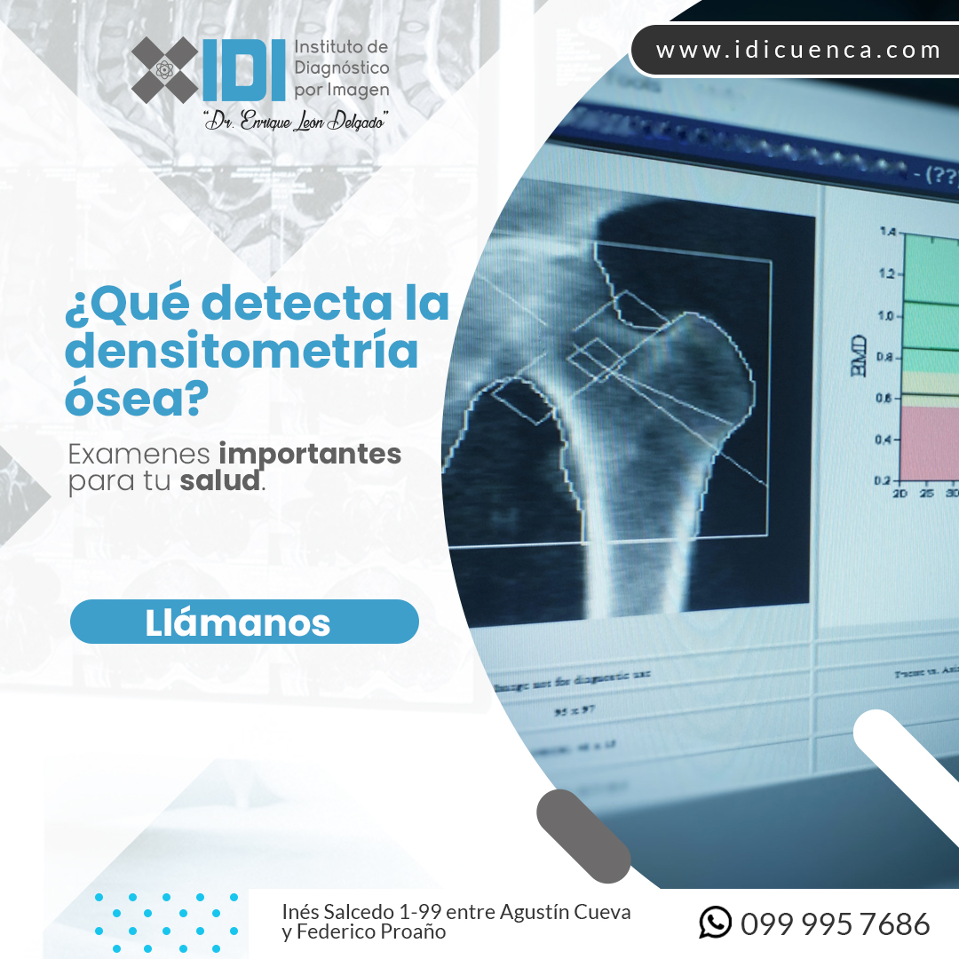 Densitometría Ósea