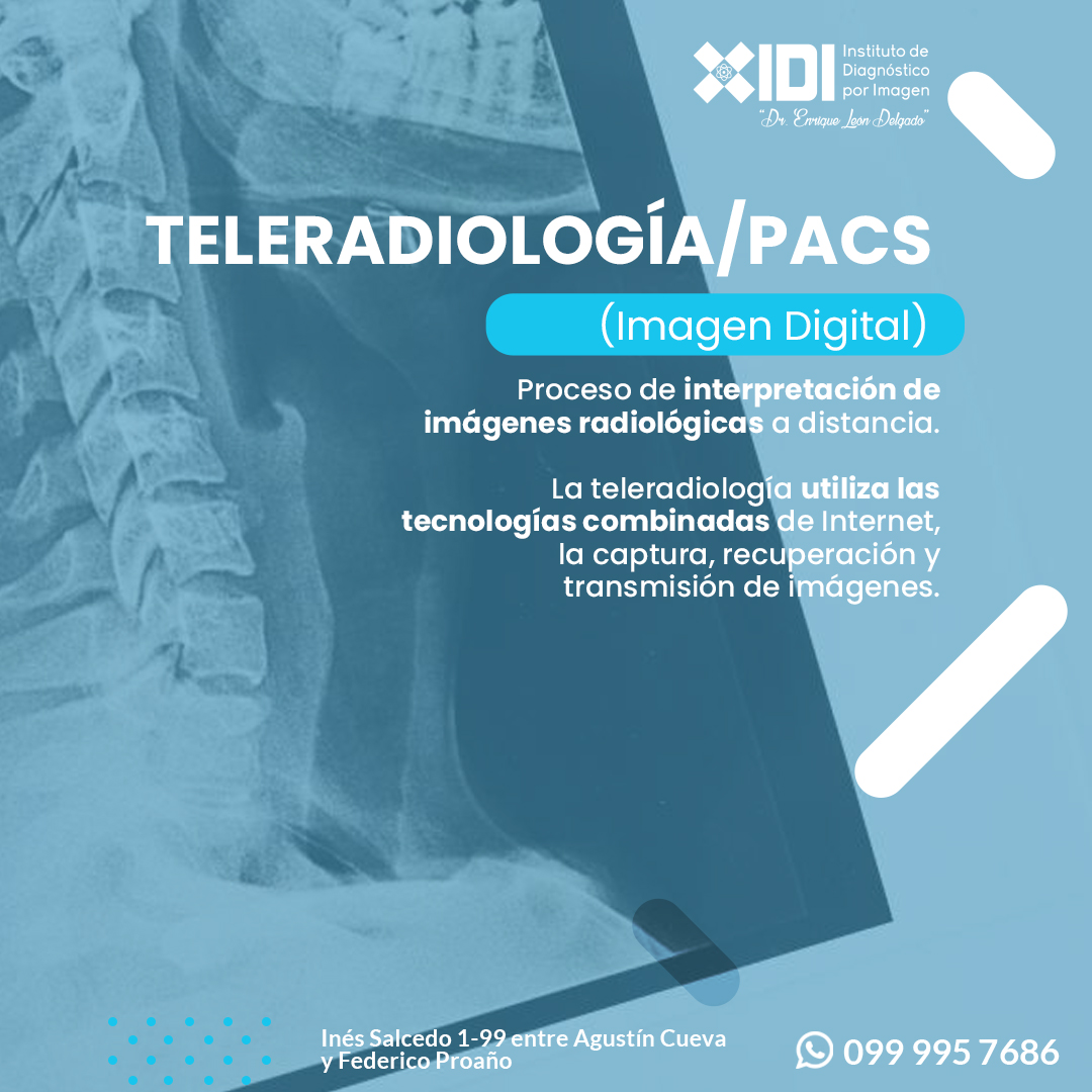 Tele radiología-PACS